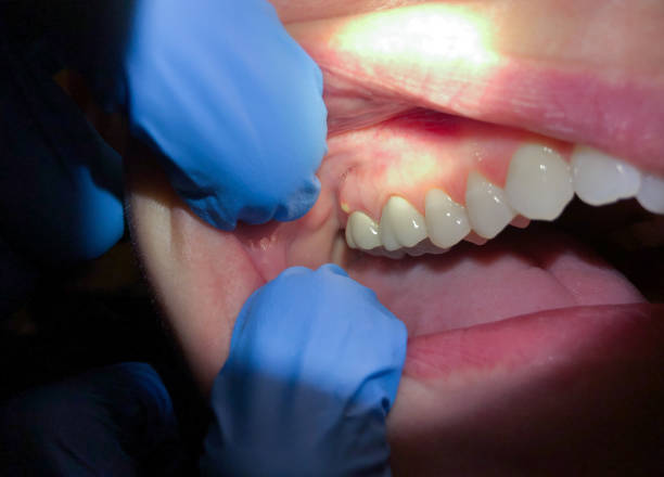 Best Emergency Treatment for Toothache in Marthasville, MO