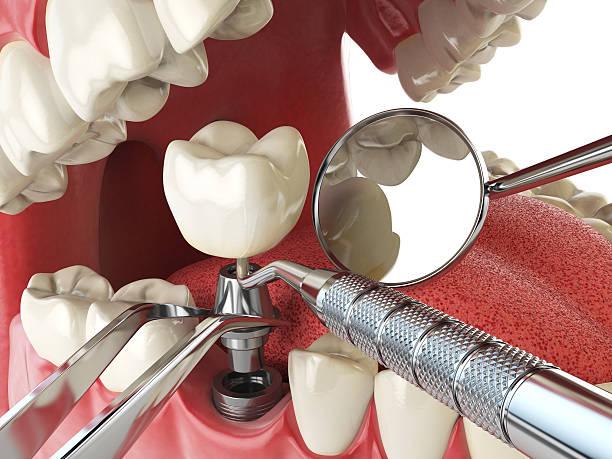 Best After-Hours Emergency Dentist in Marthasville, MO